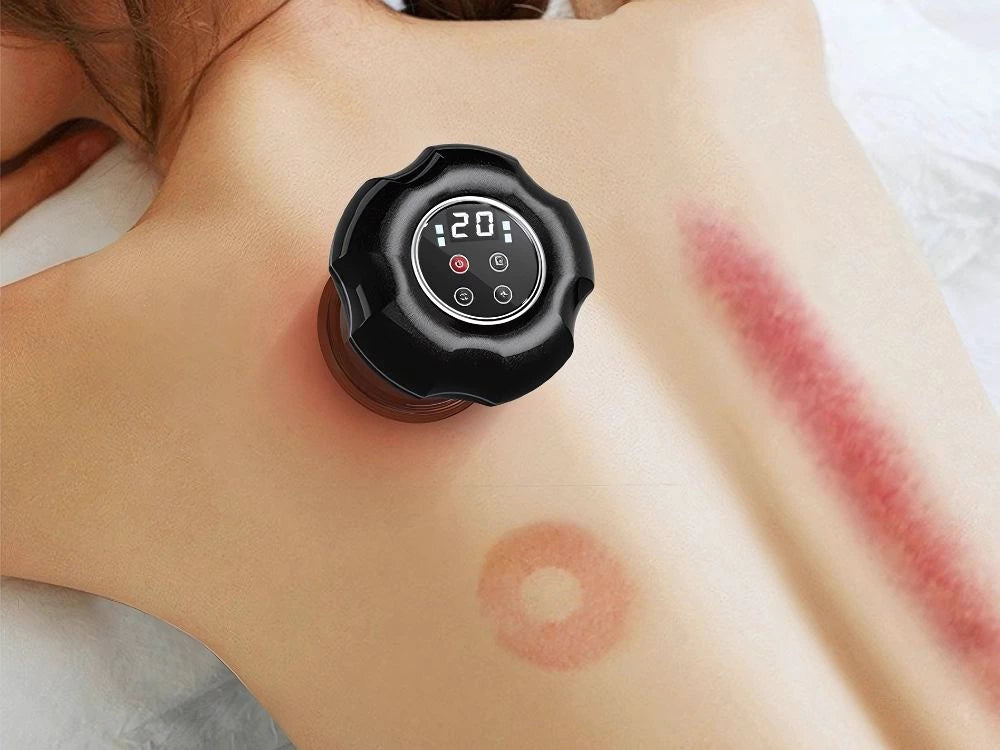 Aparat de Masaj Electric cu Vacuum și Încălzire – 12 Trepte de Aspirație