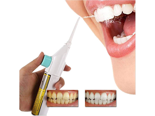 Irigator Dentar Wireless – Fără Alimentare Electrică