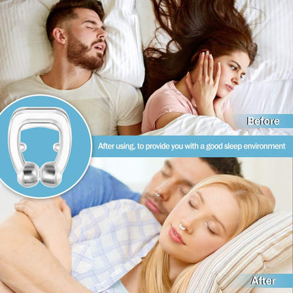 Dilatator Nazal Magnetic Anti-Sforăit